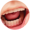 close up of Geriatric Care Teri's teeth