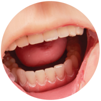 close up of Geriatric Care Teri's teeth