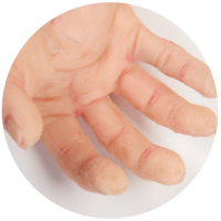 close up of Geriatric Care Teri's hand
